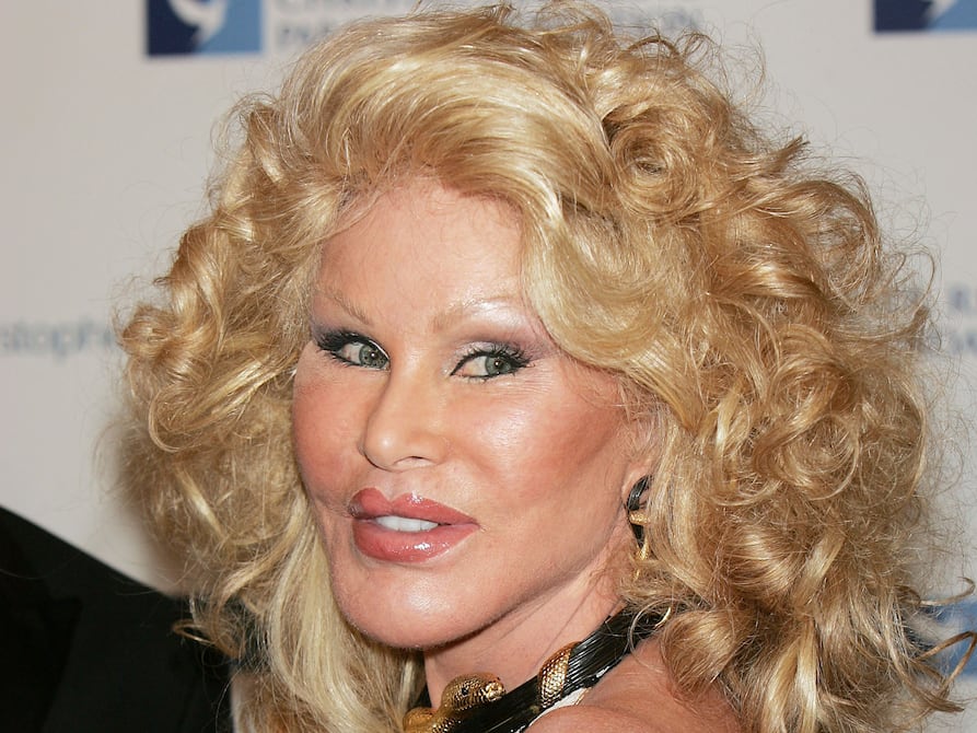 Fallece Jocelyn Wildenstein, la ‘Catwoman’ suiza, famosa por sus cirugías extremas para acentuar rasgos felinos | Gente | Entretenimiento